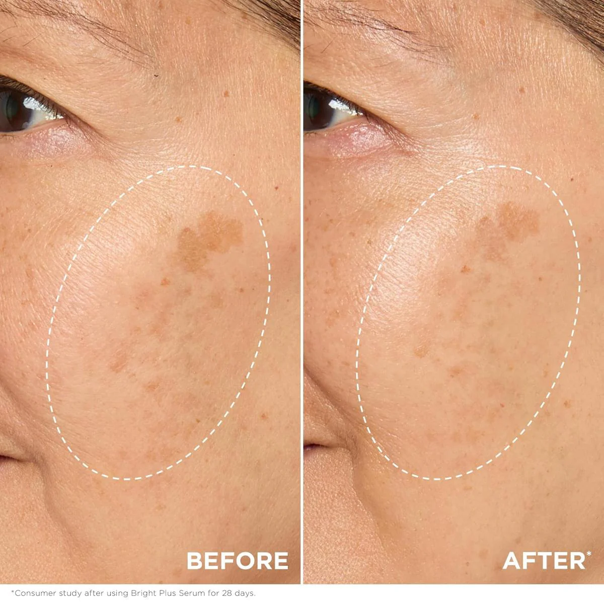 Bright Plus Advanced Serum - Image 10
