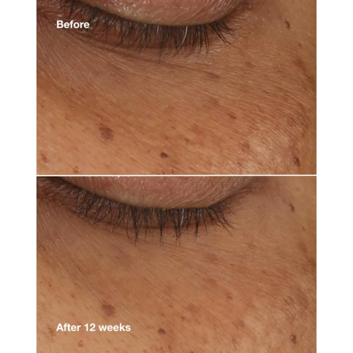 All About Eyes™ Brightening Serum Concentrate - Image 5