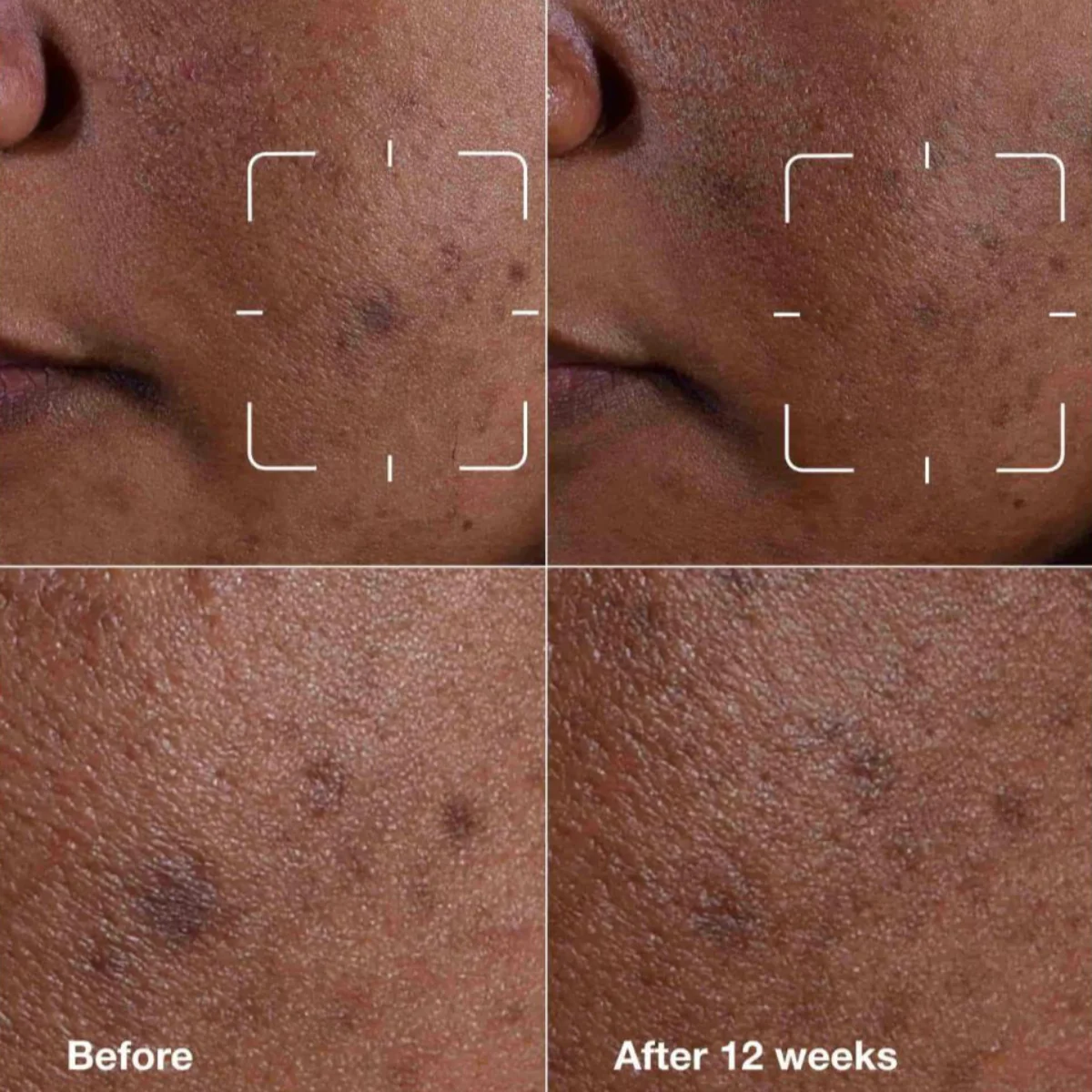 Even Better Clinical™ Dark Spot Clearing Serum - Image 5