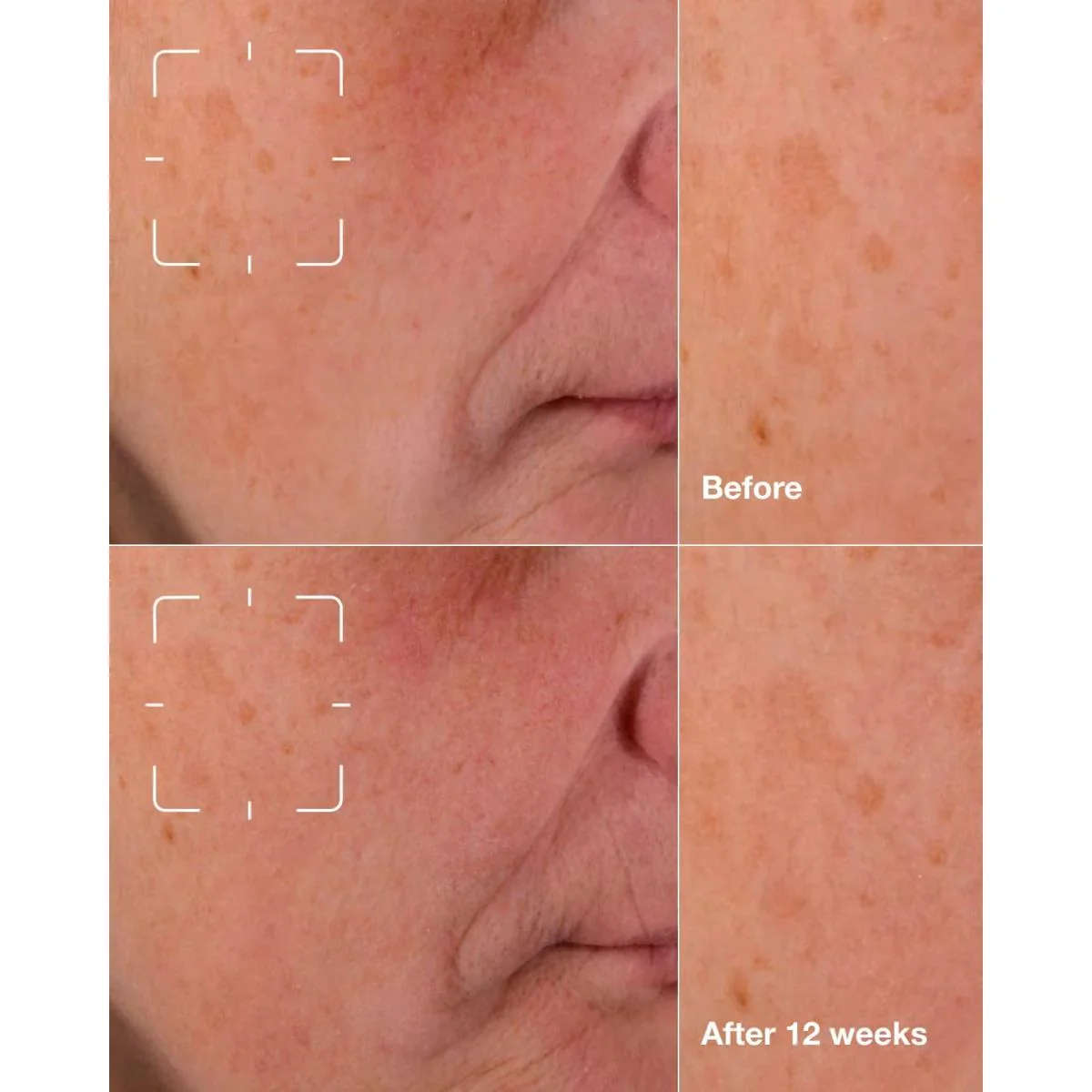 Even Better Clinical™ Dark Spot Clearing Serum - Image 6