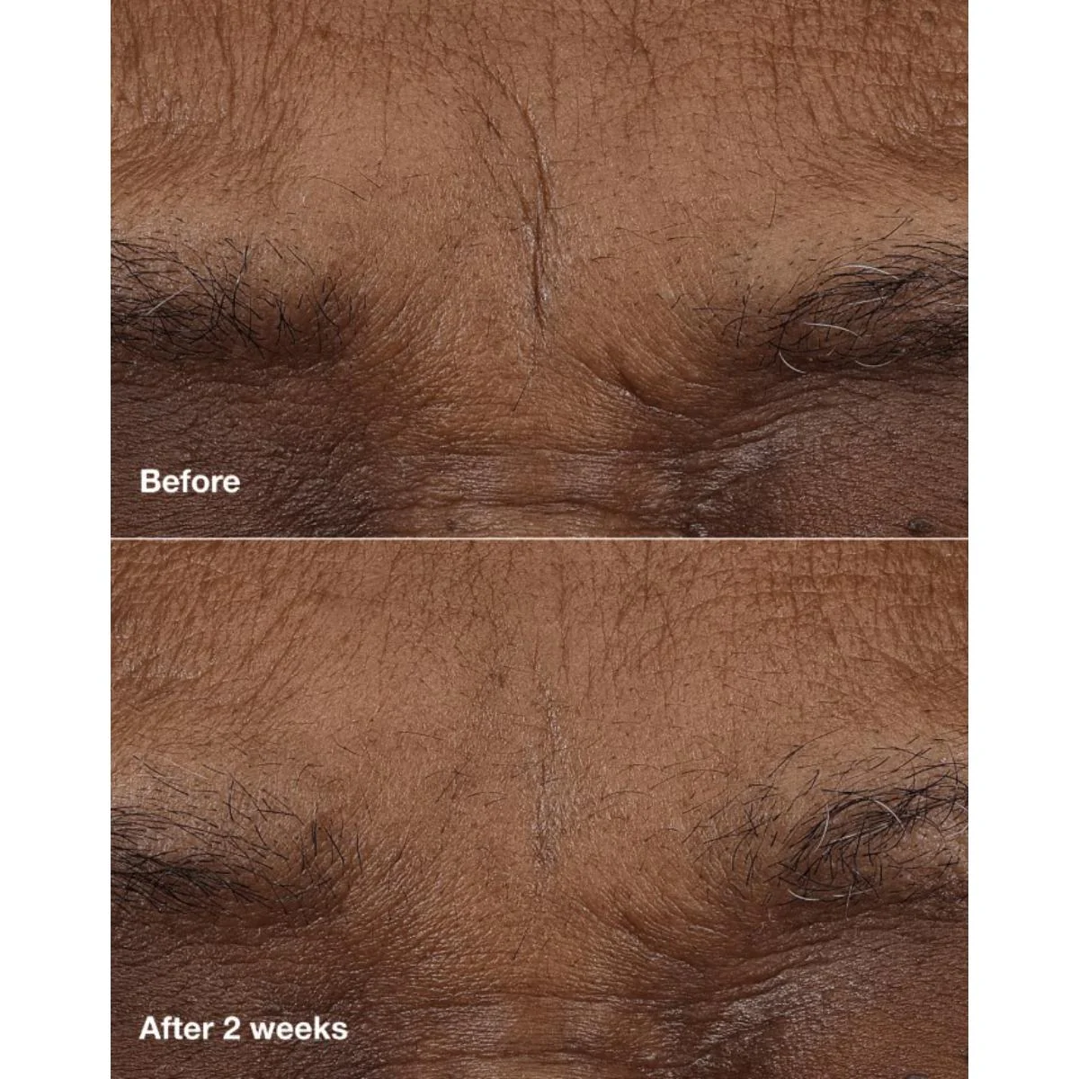 Smart Clinical Repair™ AM/PM Retinoid Balm - Image 4