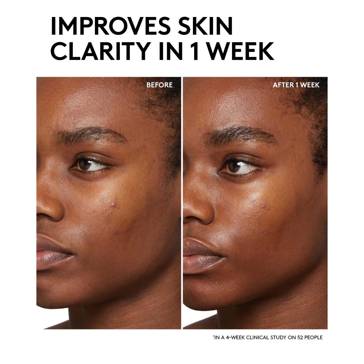 Cherry Dub BHA Toner with Salicylic Acid + Aloe Juice - Image 4