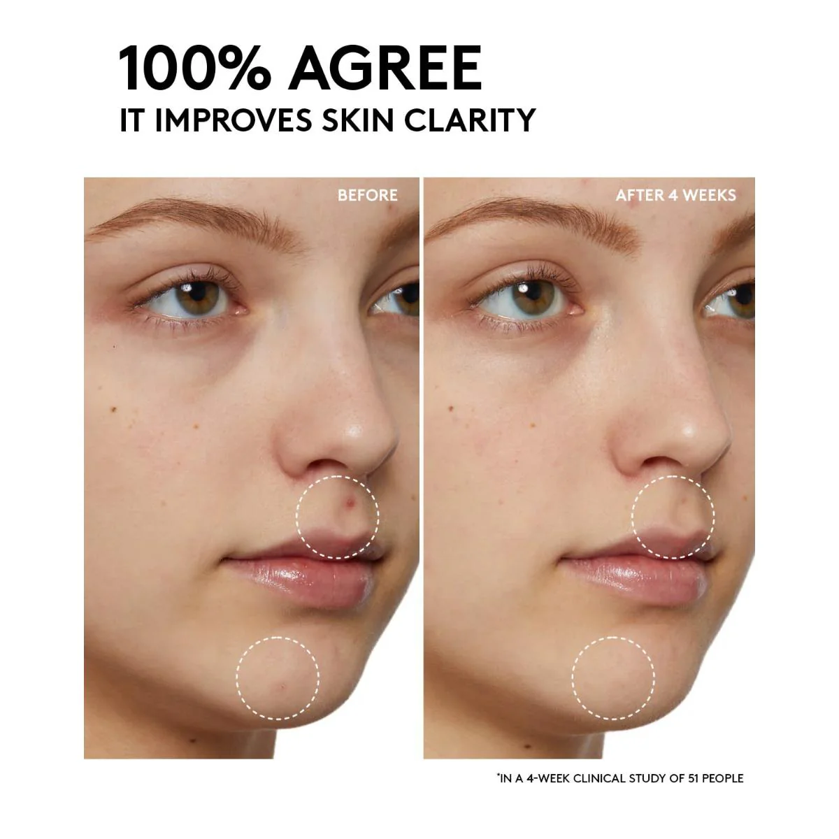 Cherry Dub Pore Purify'r Gel Cleanser with Niacinamide + Aloe Juice - Image 7