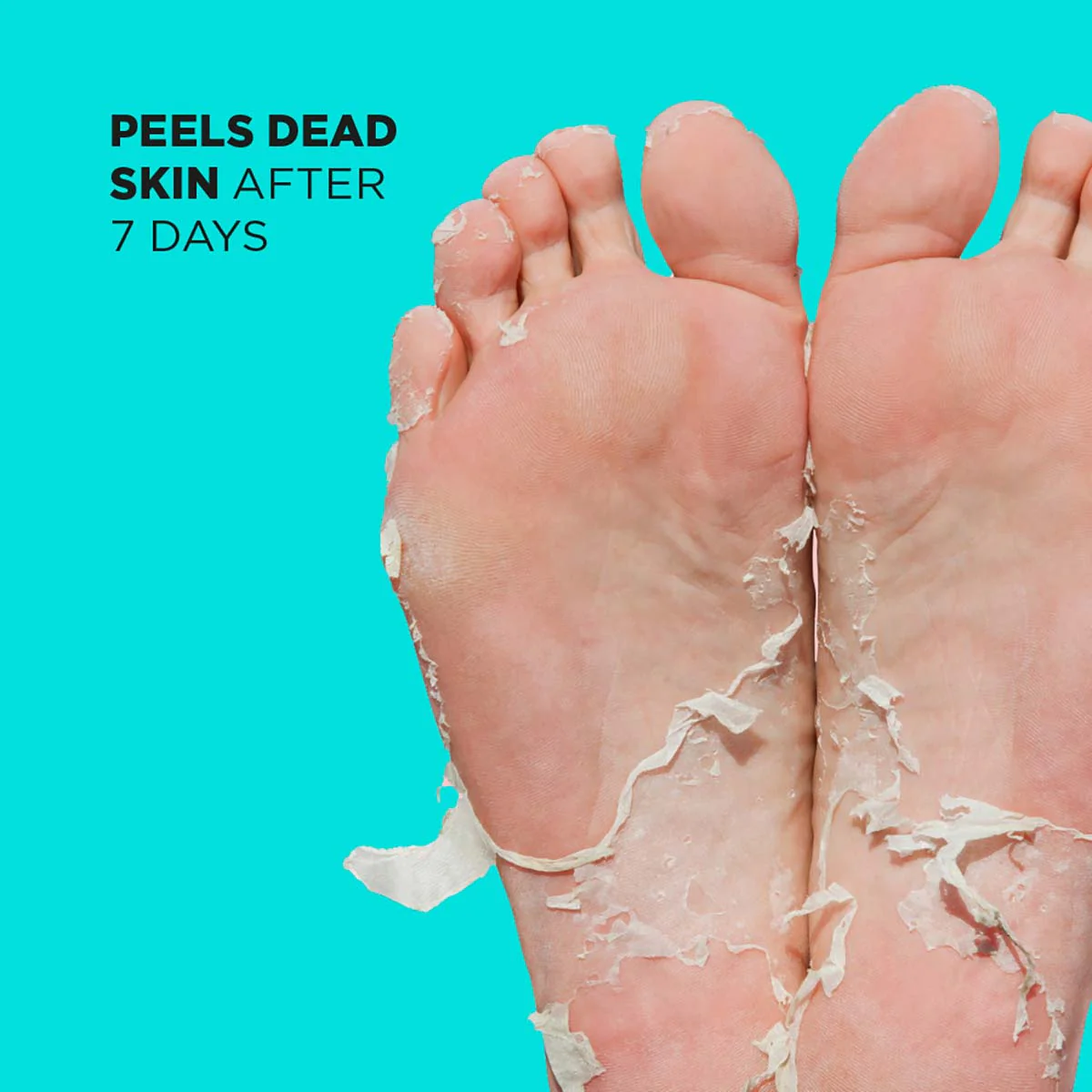Skin Republic Foot Peel Treatment - Image 3