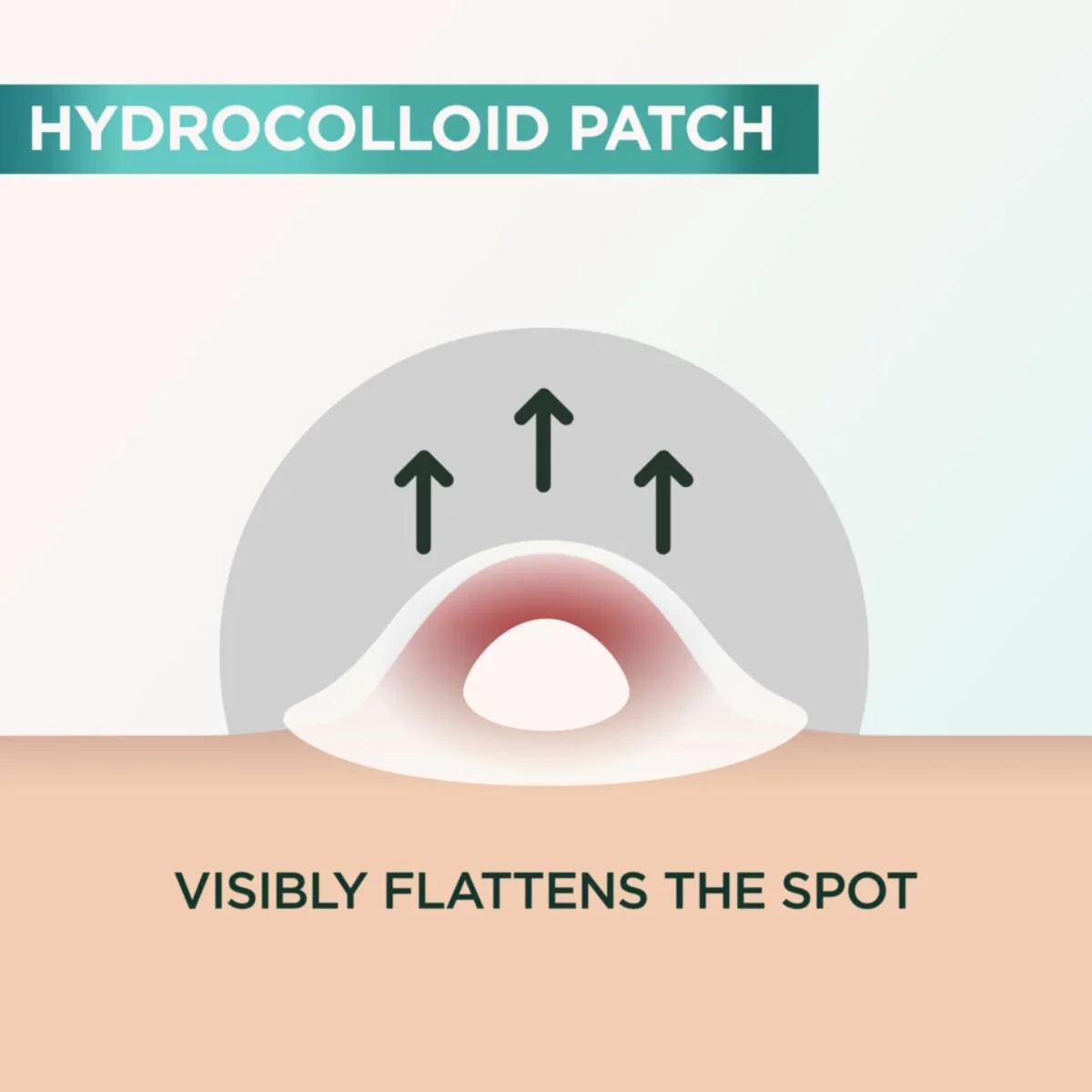 Pure Active Pimple Patches - Image 3