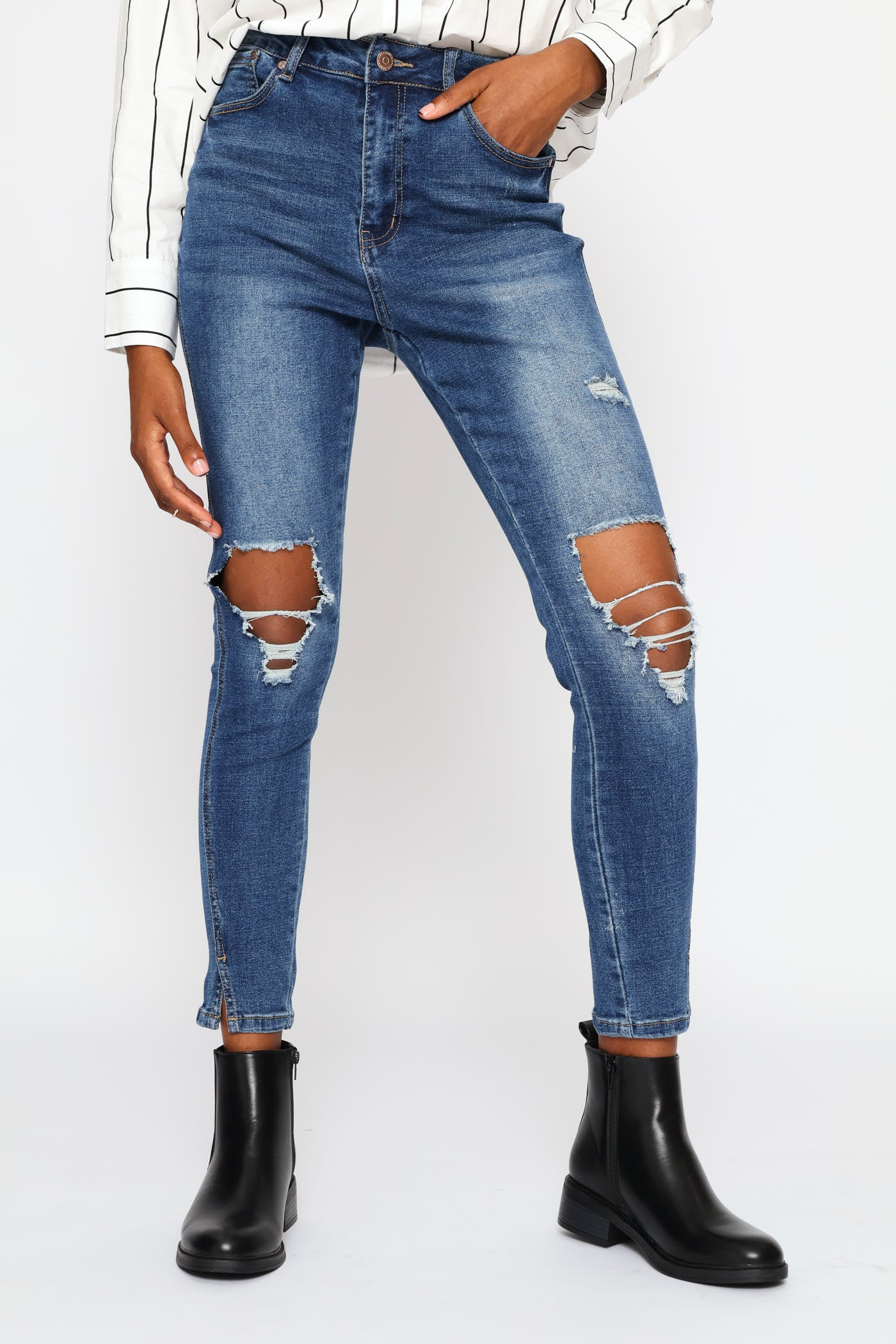 Hi-Rise Abraised Skinny Denim - Dark Wash - Image 2