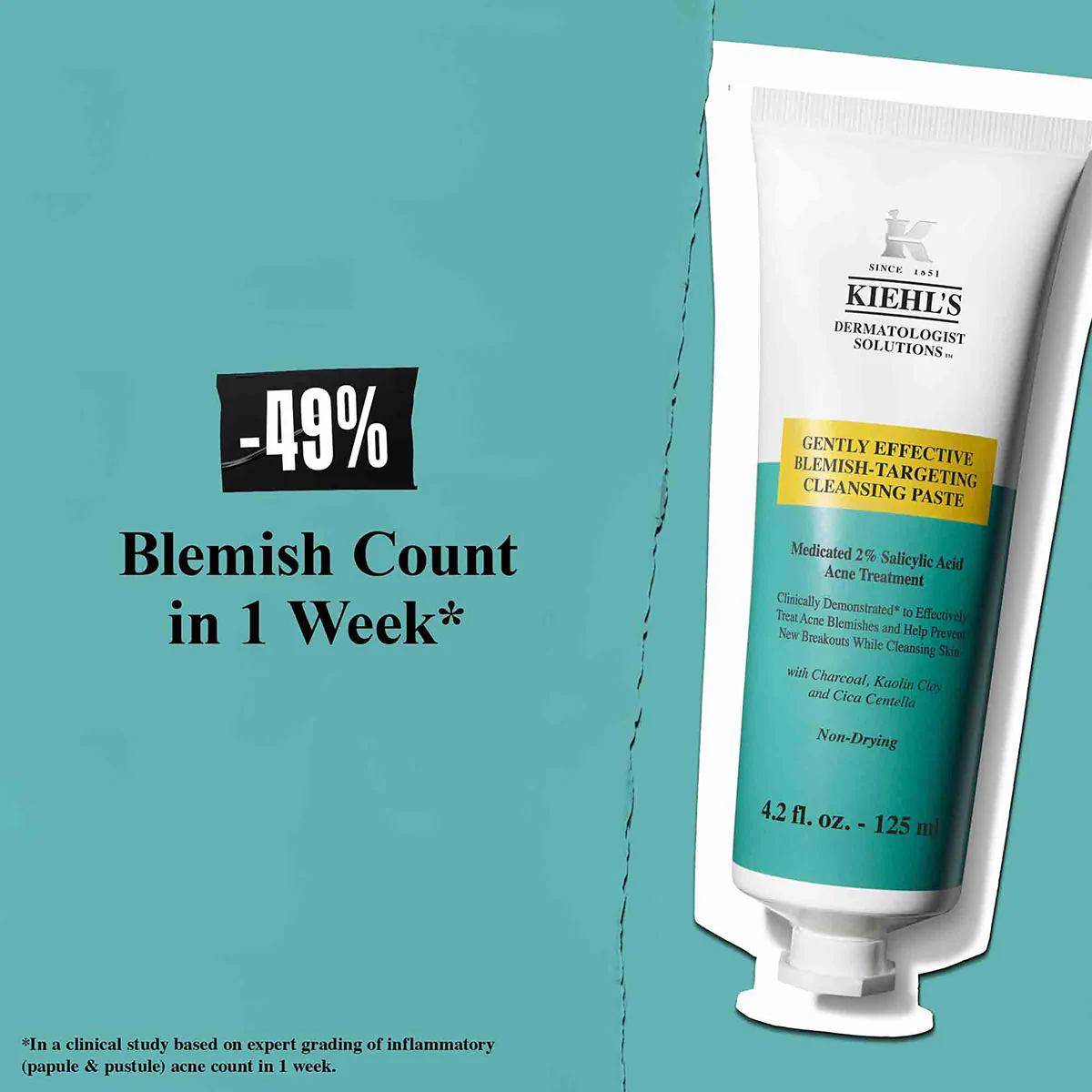 Acne Cleanser 125ml - Image 5