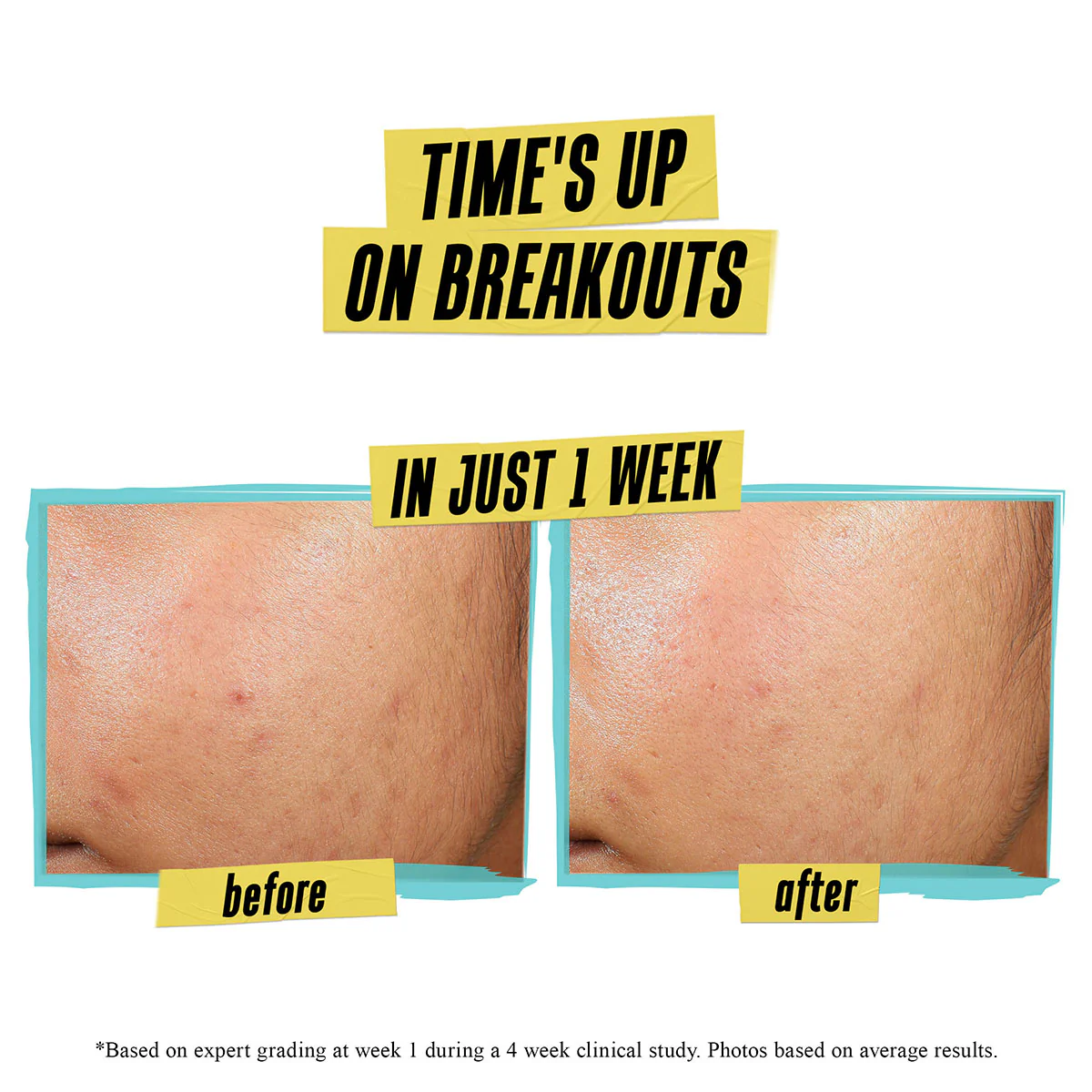 Expertly Clear Blemish-Treating & Preventing Lotion - Image 2