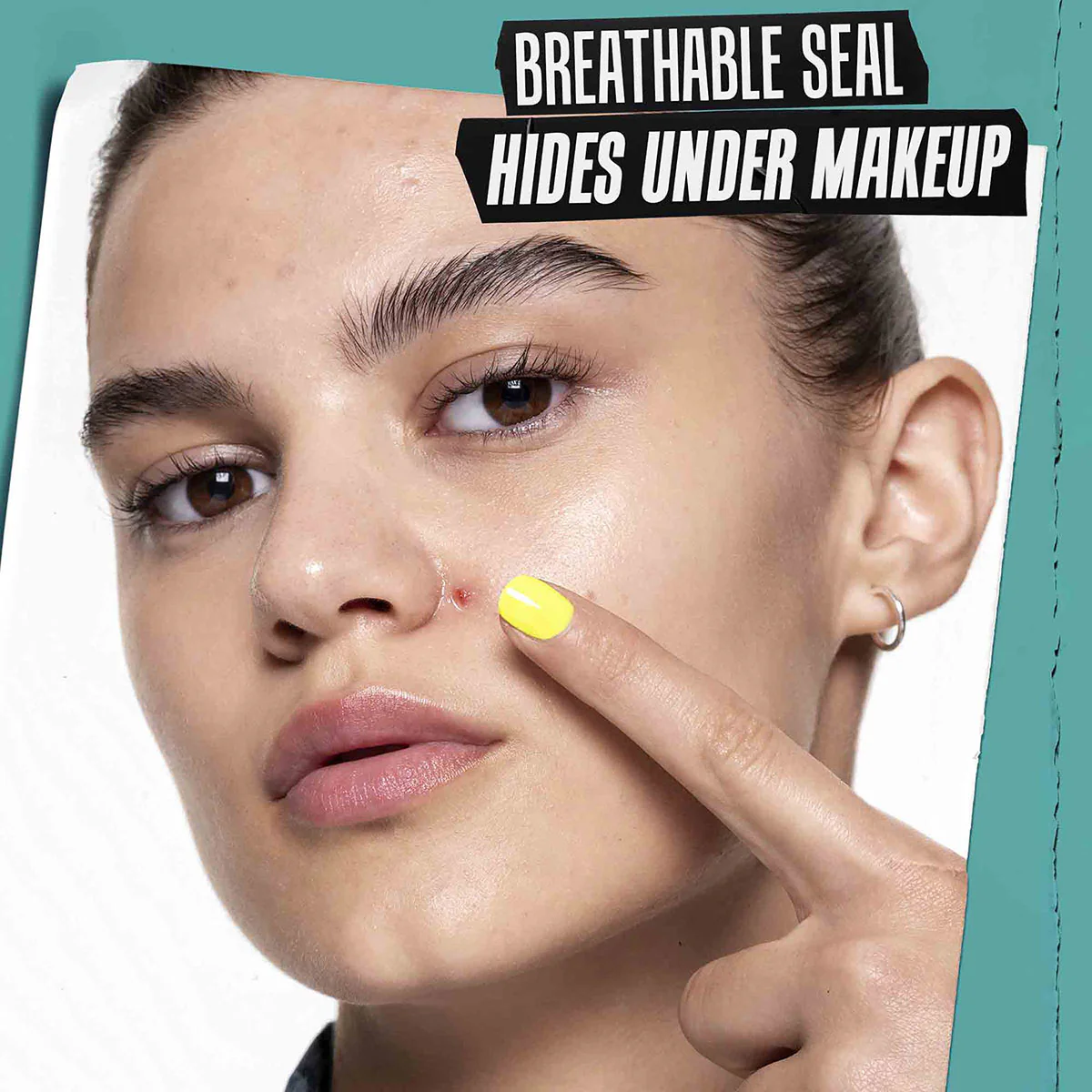 Truly Targeted Blemish-Clearing Solution - Image 5