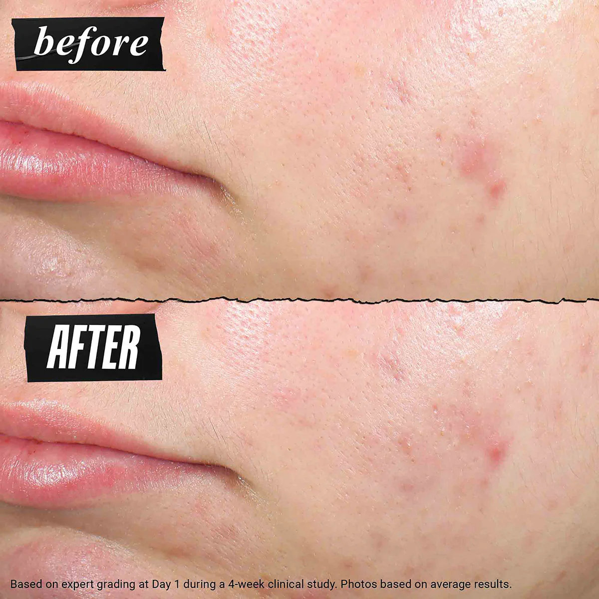 Truly Targeted Blemish-Clearing Solution - Image 7