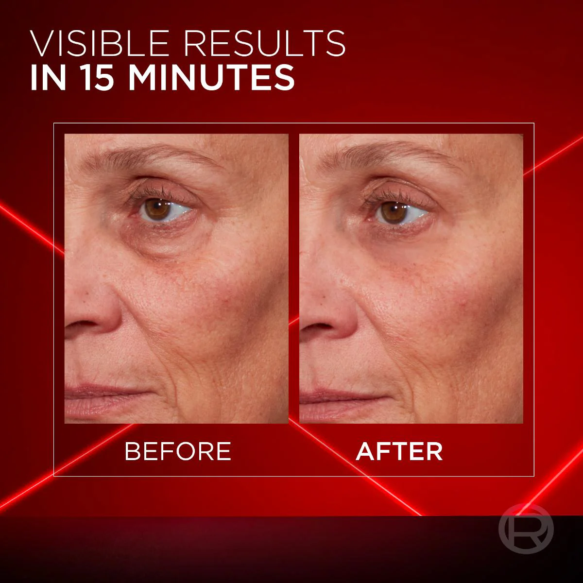 Revitalift Laser Instant Bag Eraser - Image 5