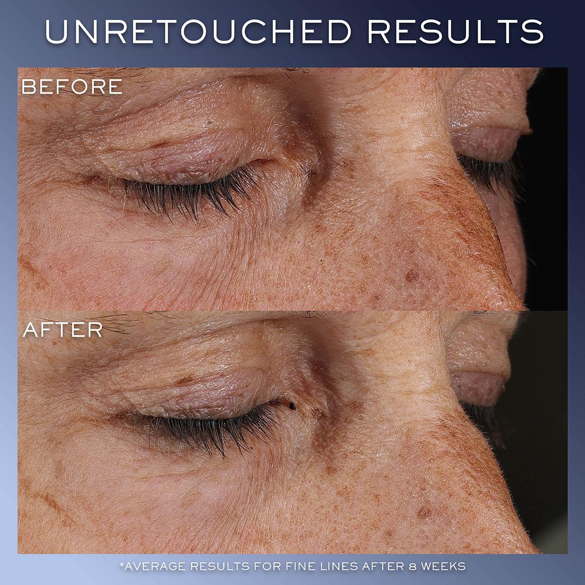 Hydrazen Day Routine Set - Image 9