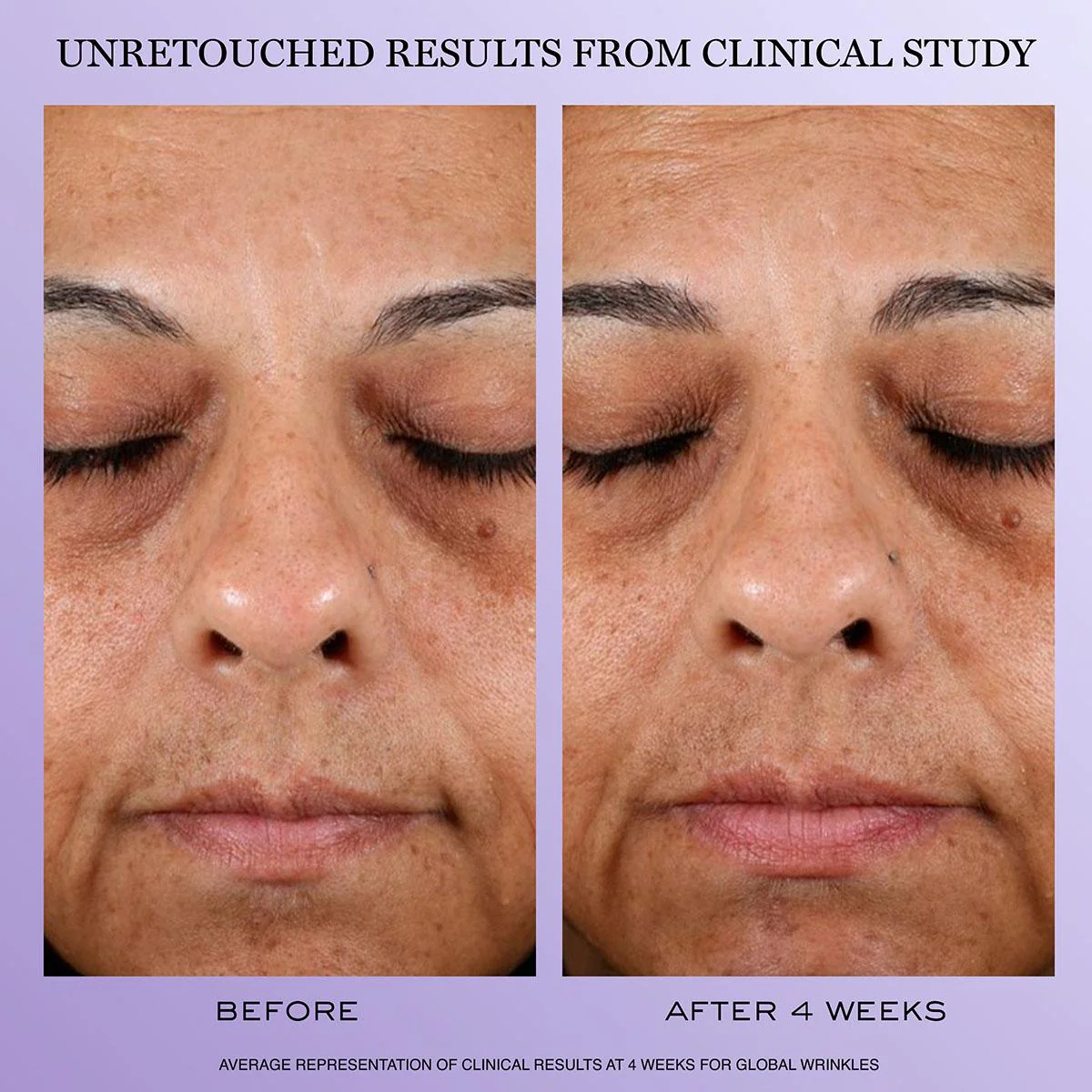 Regenerie Multi-Lift Routine Set - Image 6