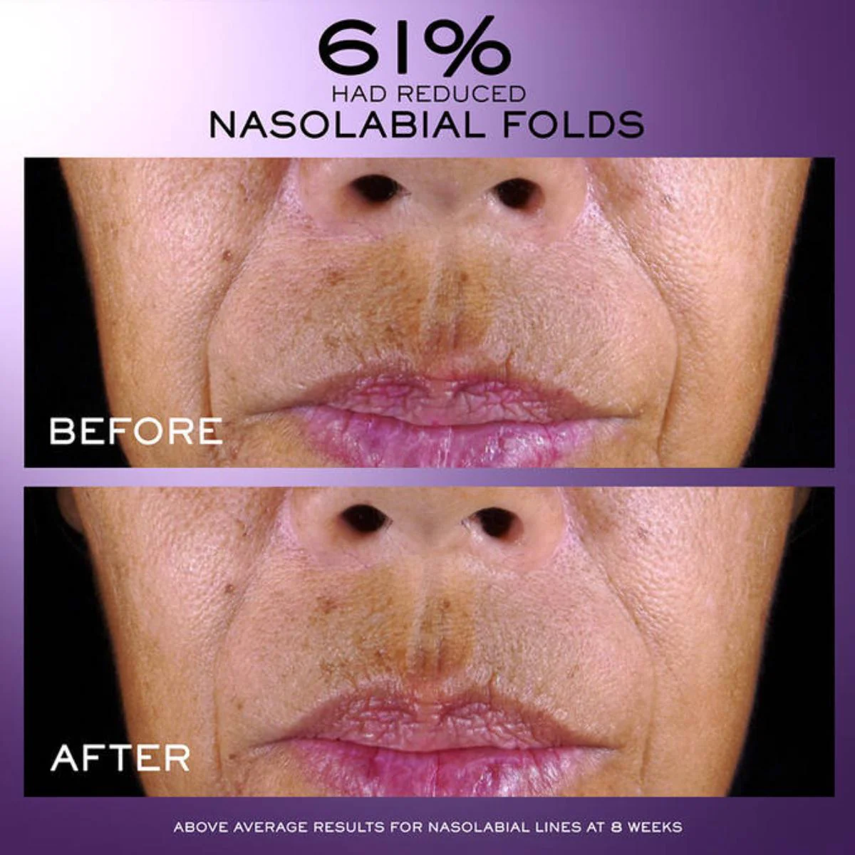 Rénergie C.R.x. Triple Serum Retinol - Image 10