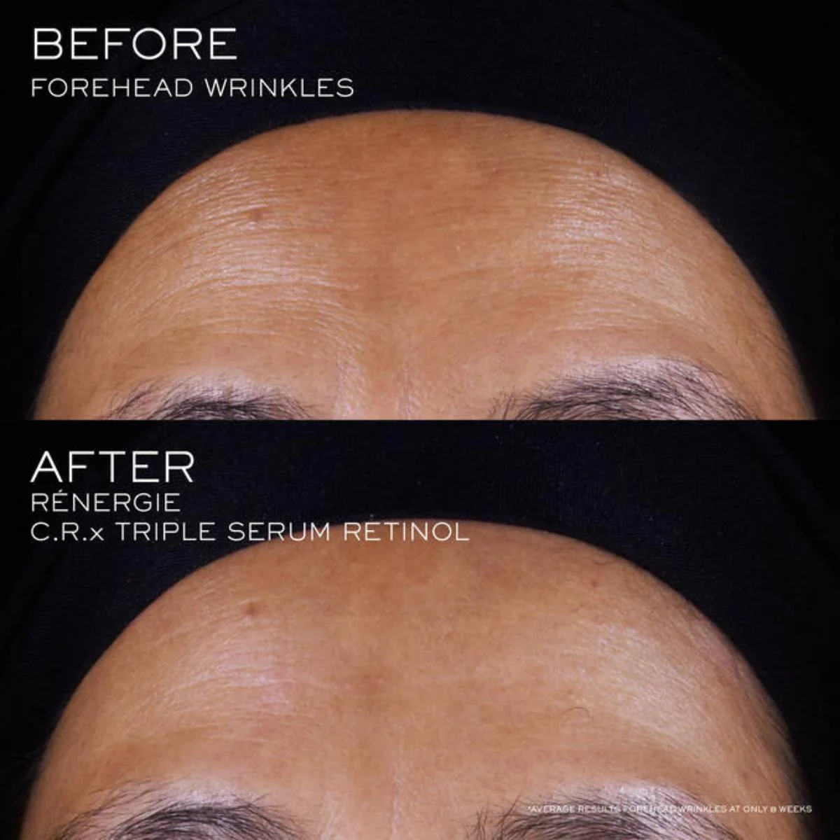 Rénergie C.R.x. Triple Serum Retinol - Image 8