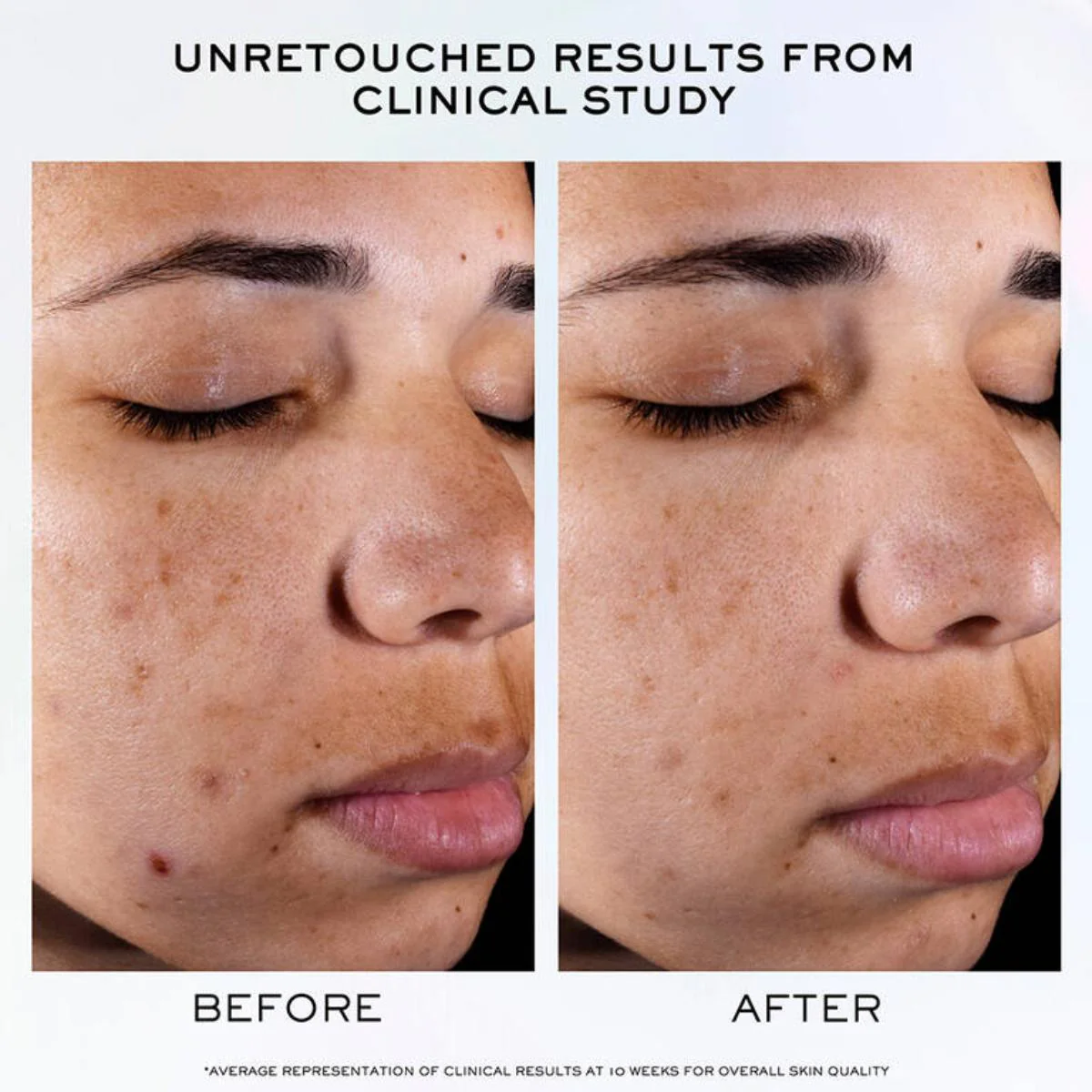 Clarifique Pro-Solution Serum - Image 6