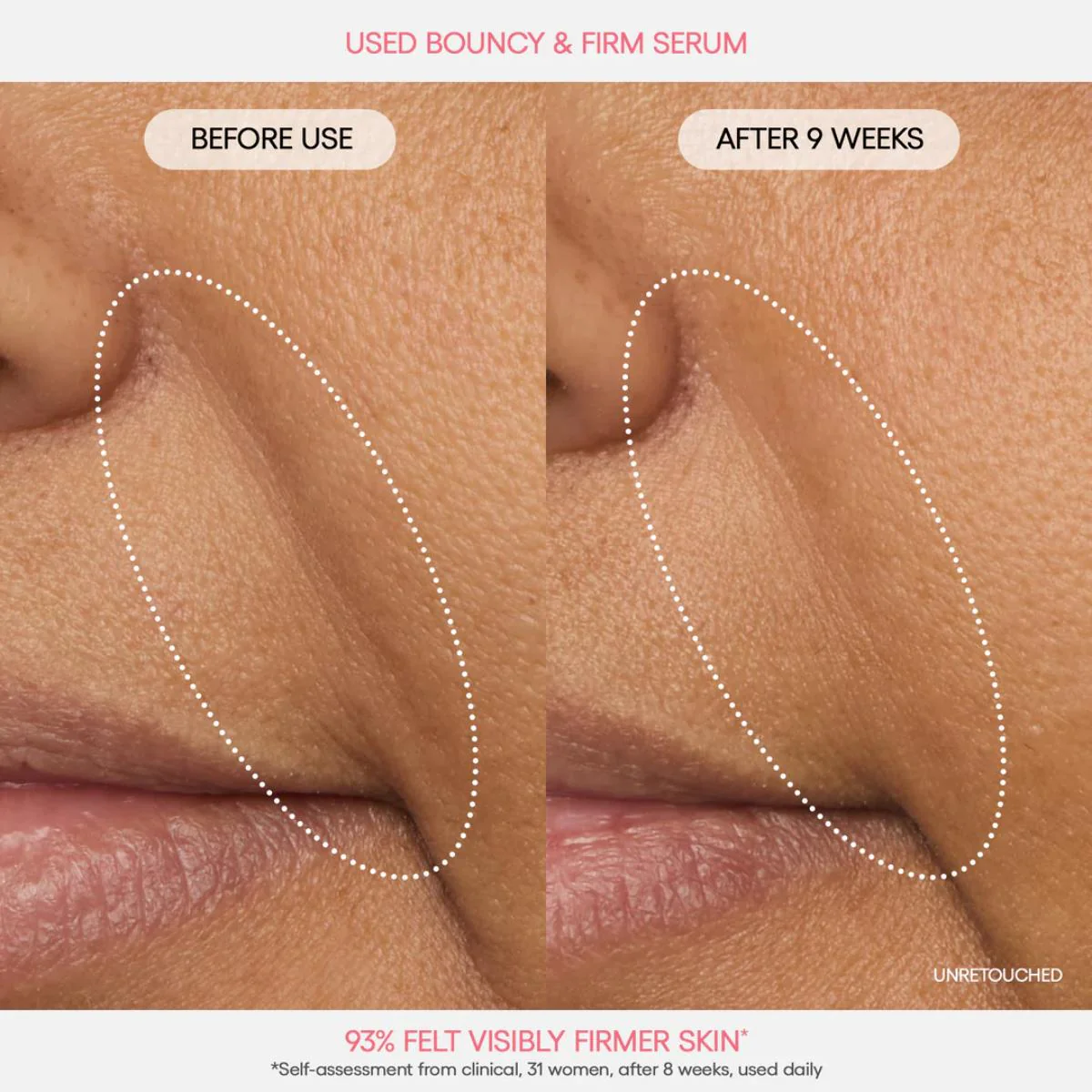 Bouncy & Firm Serum - Image 4
