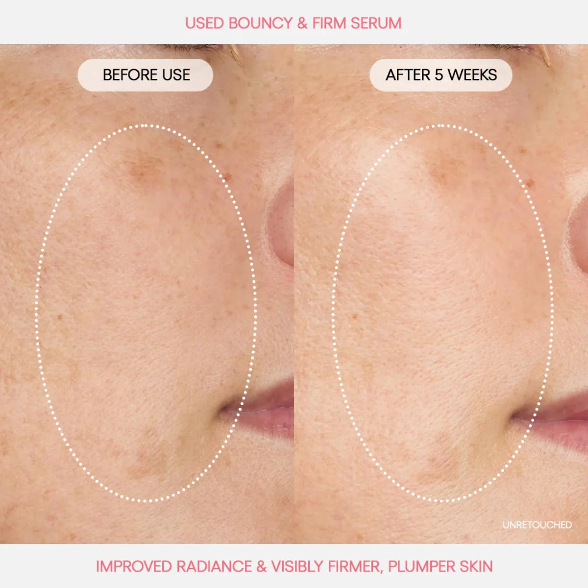 Bouncy & Firm Serum - Image 5