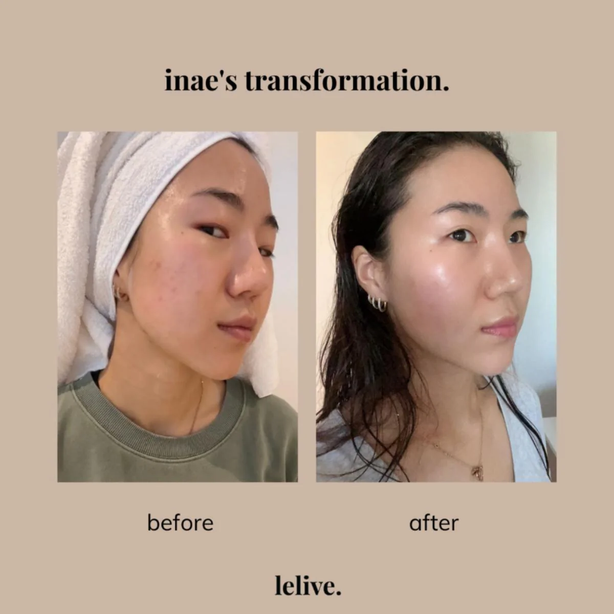 Save Our Skin (SOS) - Exfoliating & Control Serum - Image 5