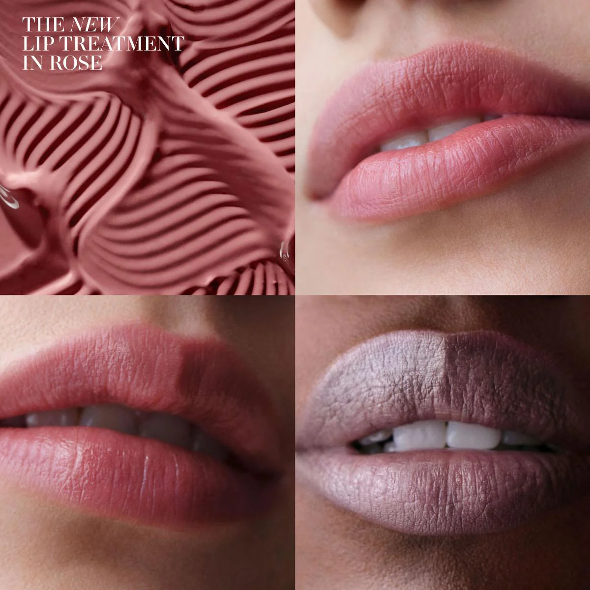 The Lip Treatment - Image 12