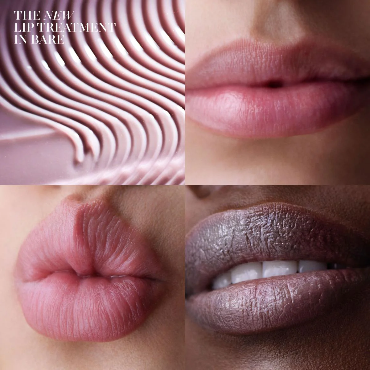 The Lip Treatment - Image 3