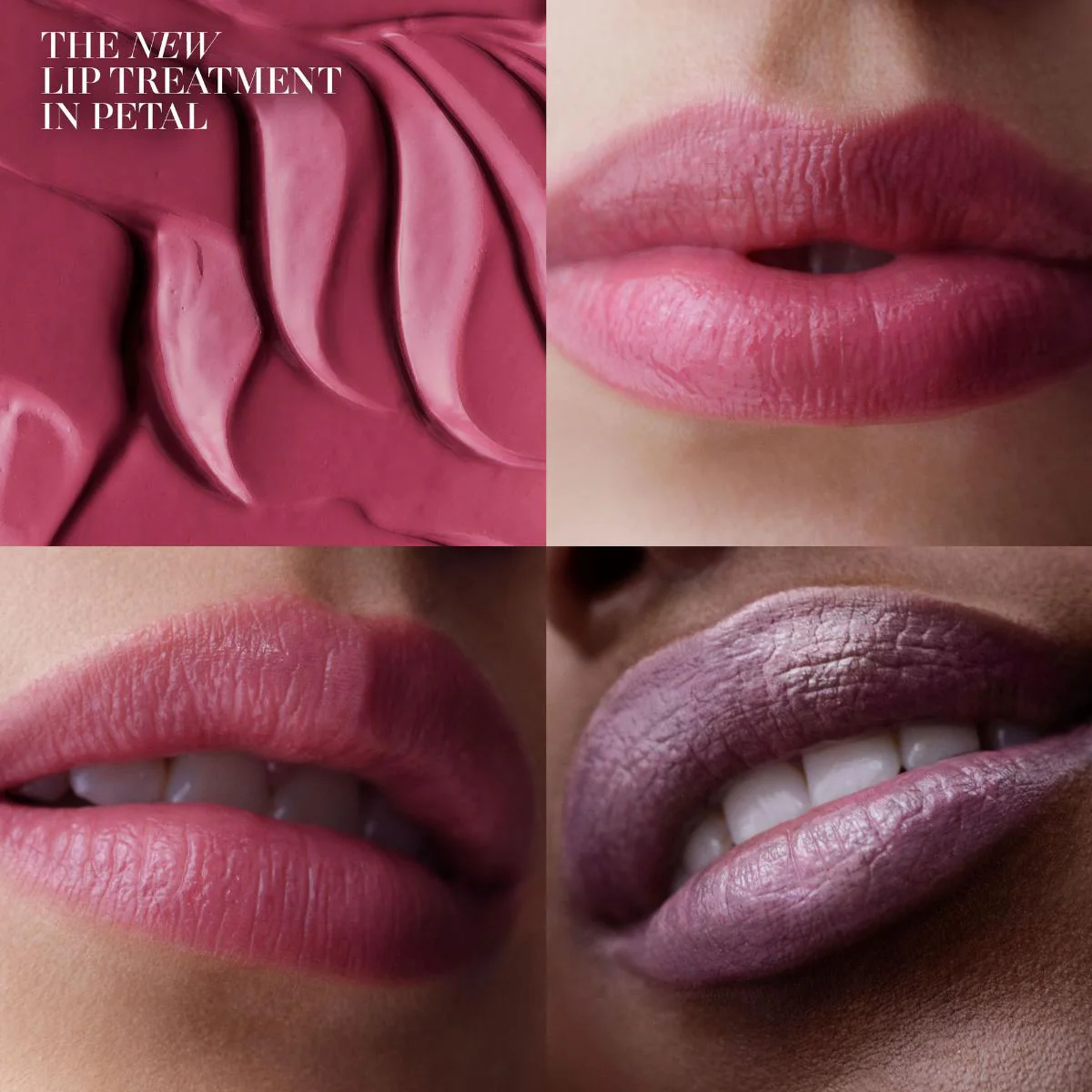 The Lip Treatment - Image 3