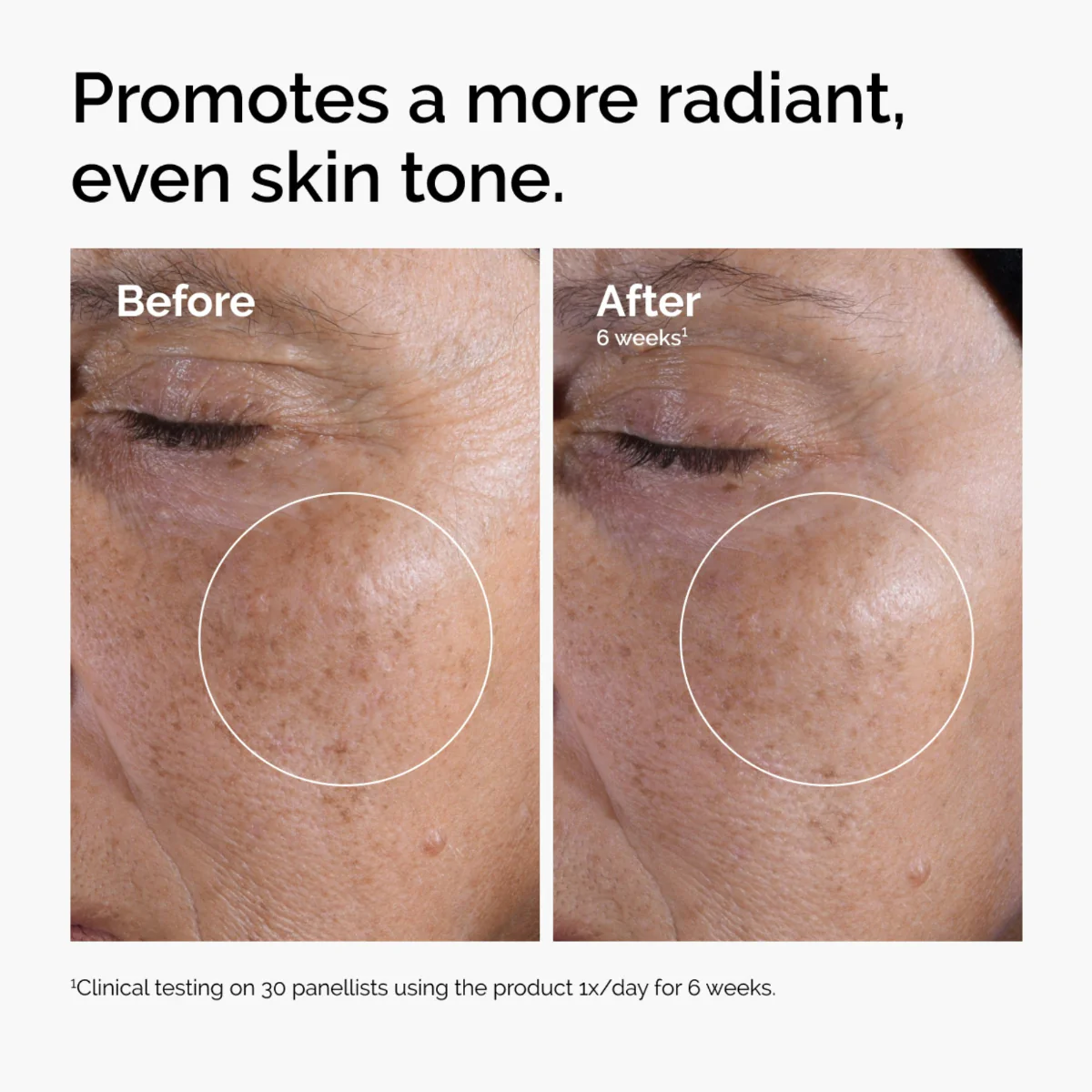 Glycolic Acid 7% Exfoliating Toner | The Ordinary - Image 9