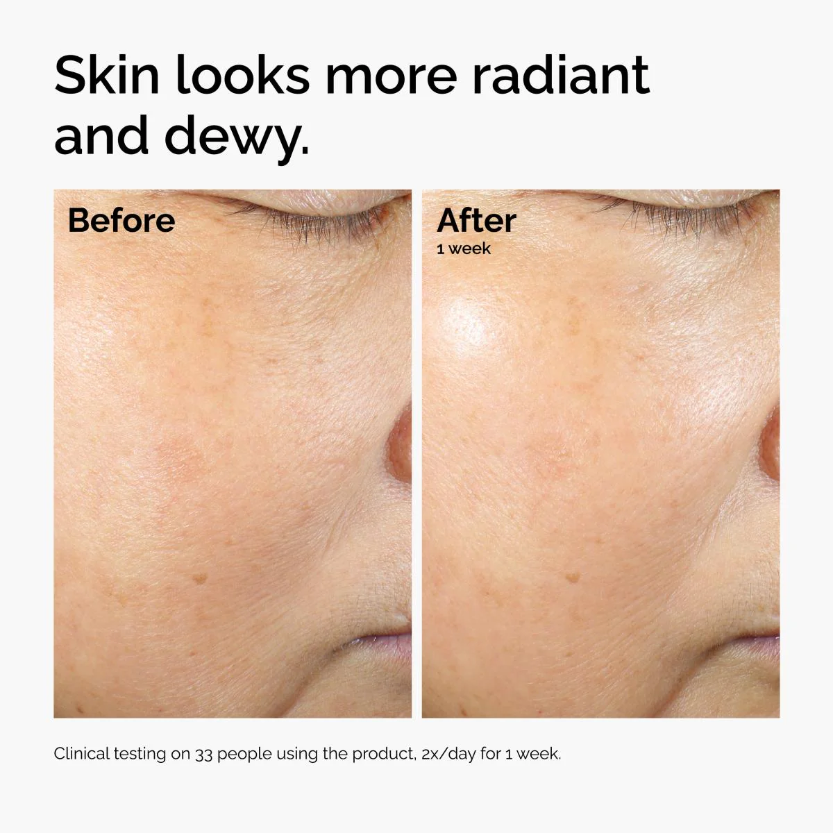 Rice Lipids + Ectoin Microemulsion | The Ordinary - Image 3
