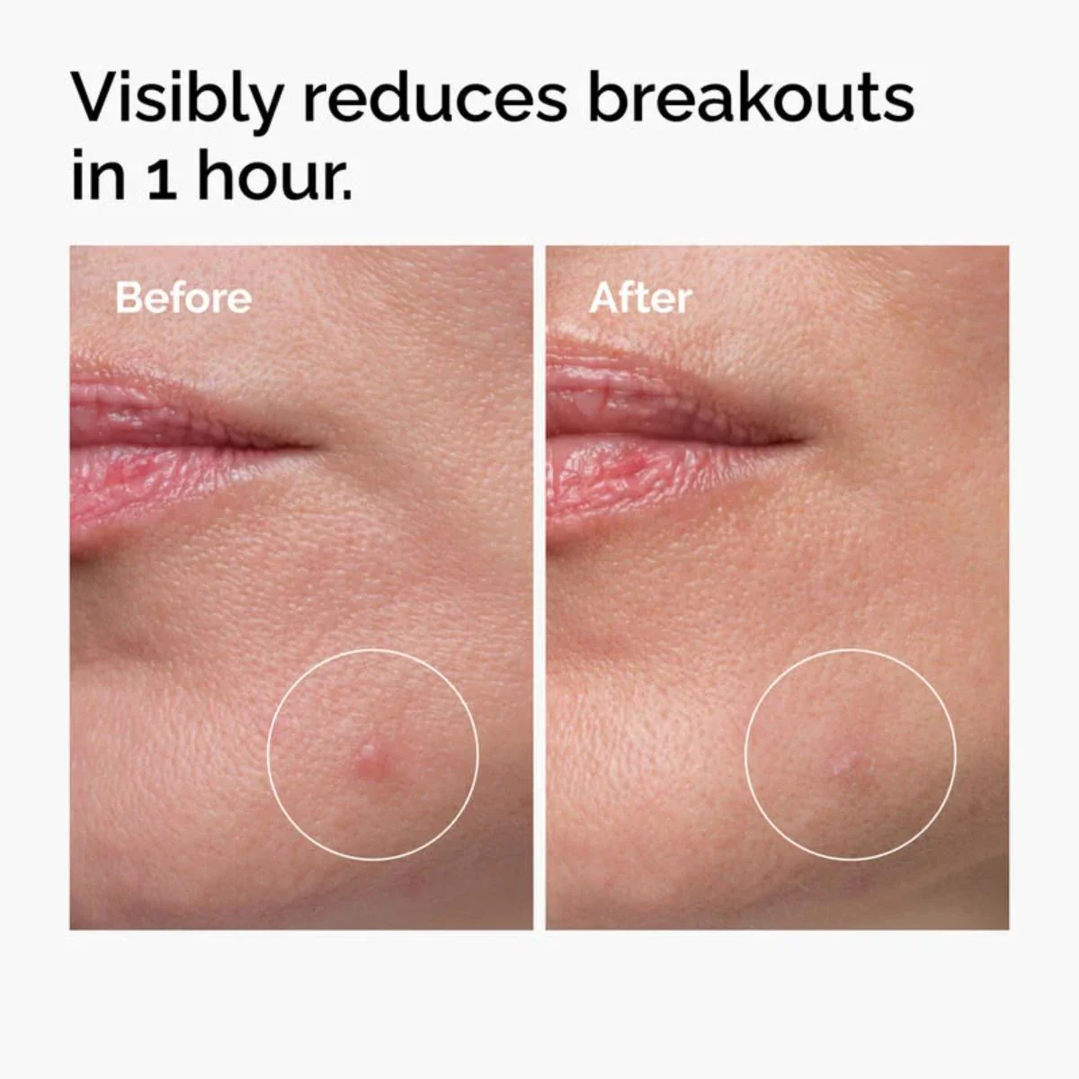 Sulfur 10% Powder-to-Cream Concentrate | The Ordinary - Image 4