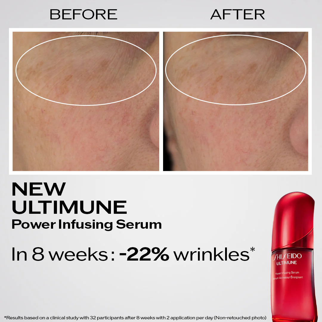 Ultimune Power Infusing Serum - Image 10