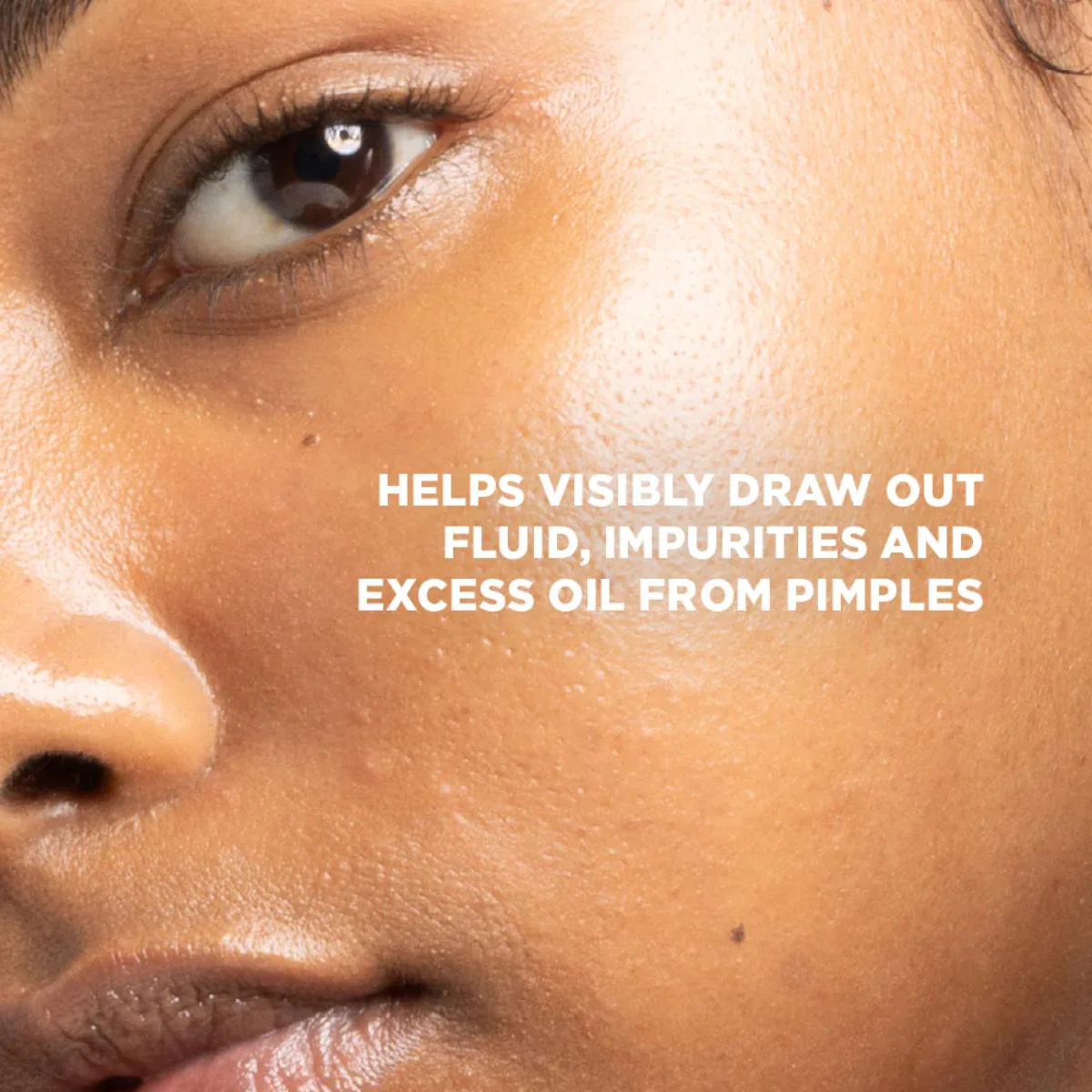 Skin Republic XL Spot Clear Patch (10 Patches) - Image 4