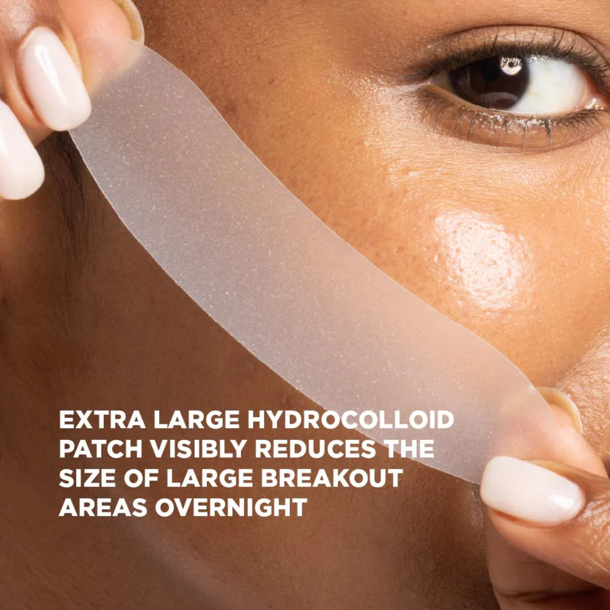 Skin Republic XL Spot Clear Patch (10 Patches) - Image 6