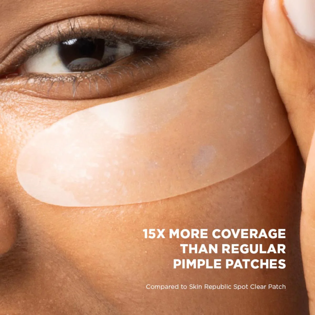 Skin Republic XL Spot Clear Patch (10 Patches) - Image 7