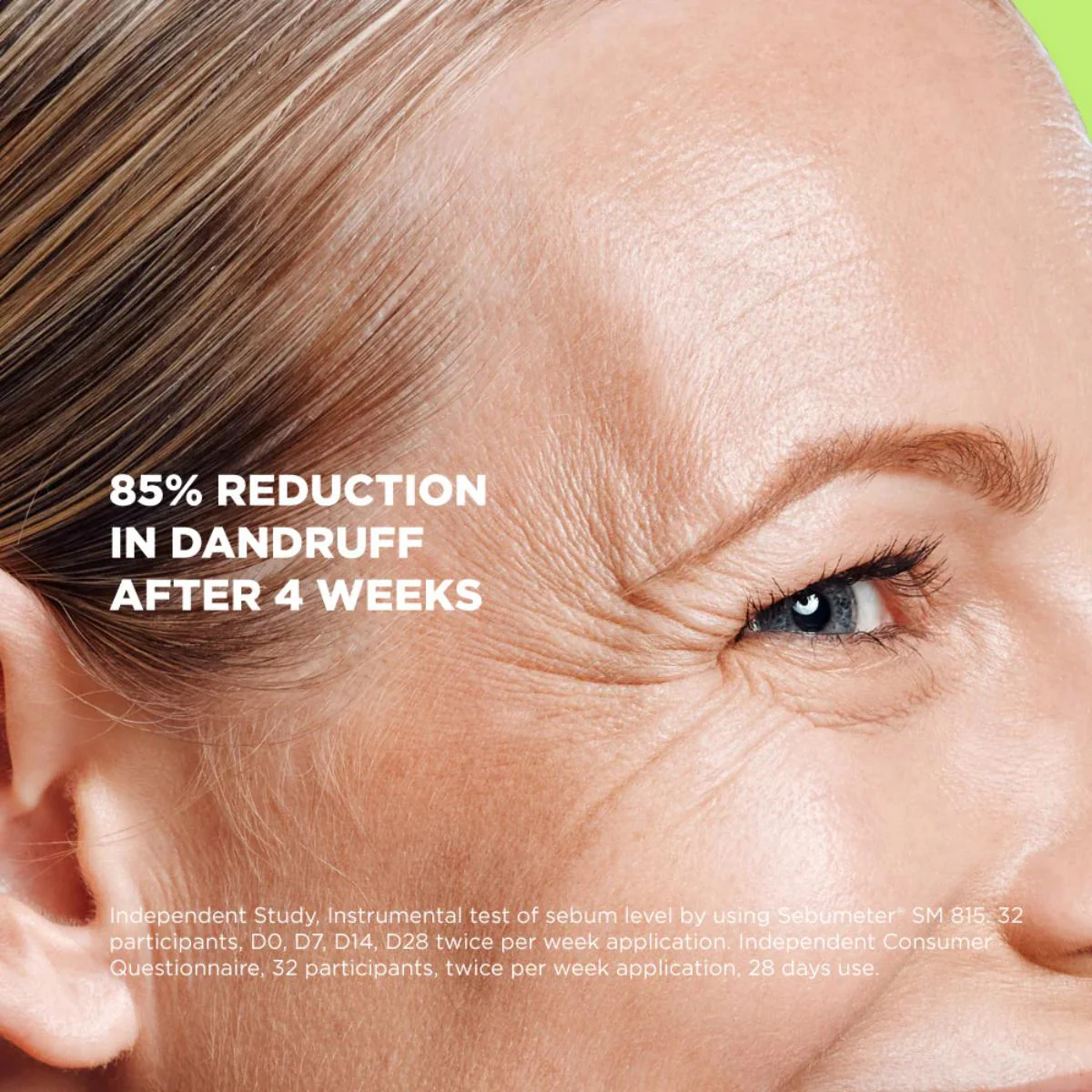 Salicylic Acid 2% + Urea 5% Scalp Serum - Image 7
